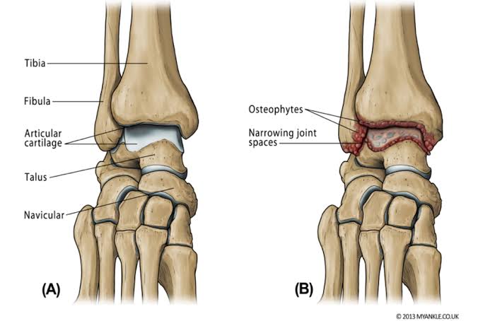 Detail Kerangka Kaki Manusia Nomer 36