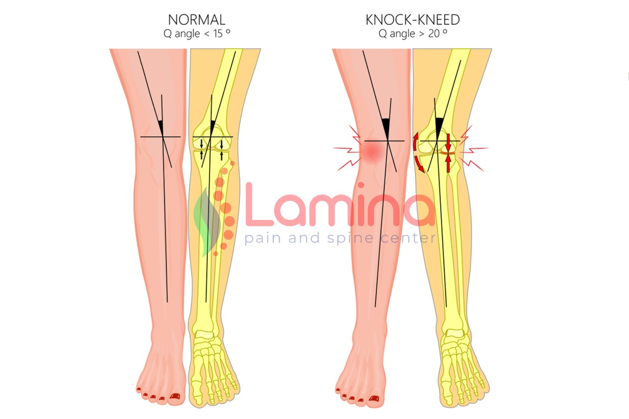 Detail Kerangka Kaki Manusia Nomer 48