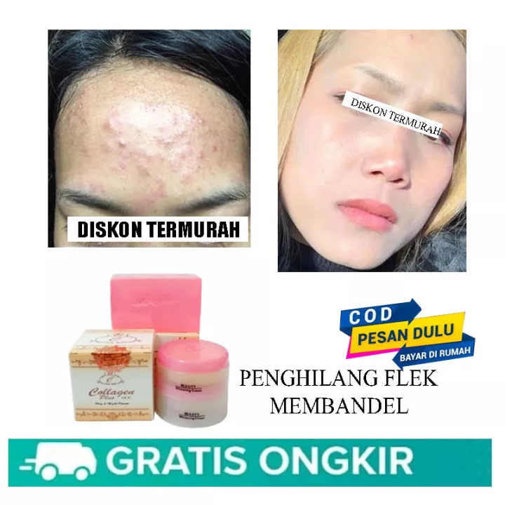 Detail Krim Kolagen Untuk Wajah Nomer 10