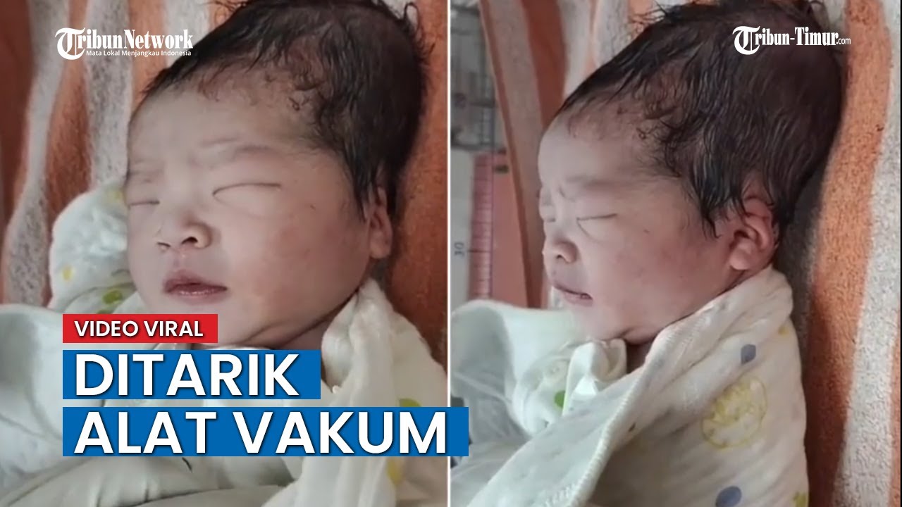 Detail Kumpulan Bentuk Kepala Bayi Nomer 41