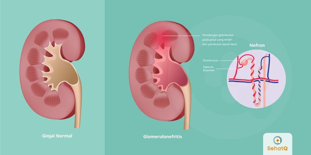 Detail Link Untuk Melihat Gambar Struktur Pada Obat Nomer 36