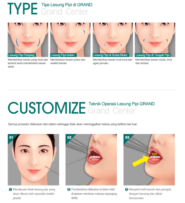 Detail Macam Macam Lesung Pipi Nomer 11