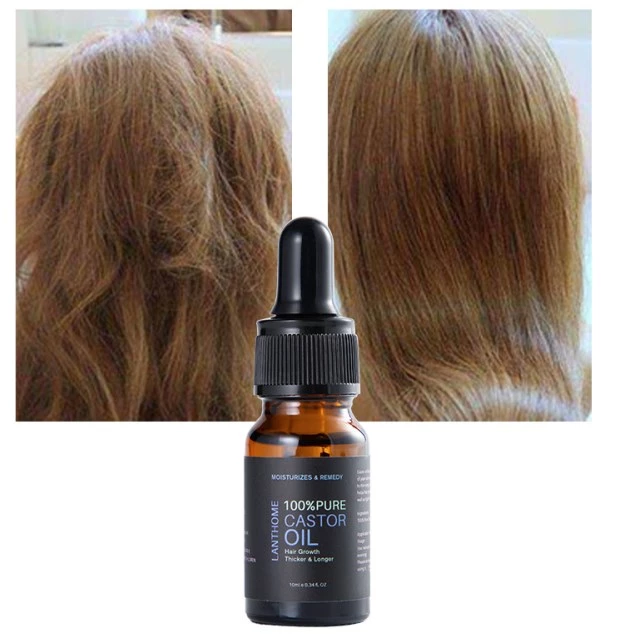 Detail Minyak Jarak Untuk Rambut Nomer 41