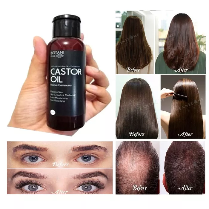 Detail Minyak Jarak Untuk Rambut Nomer 45