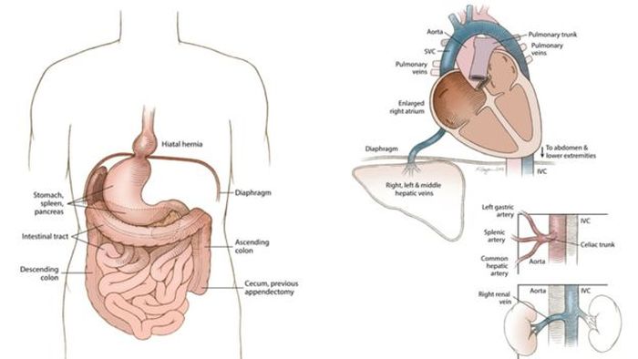 Detail Organ Perut Manusia Nomer 11