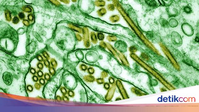 Detail Penyakit Yang Disebabkan Oleh Virus Pada Manusia Dan Penjelasannya Gambar Nomer 19