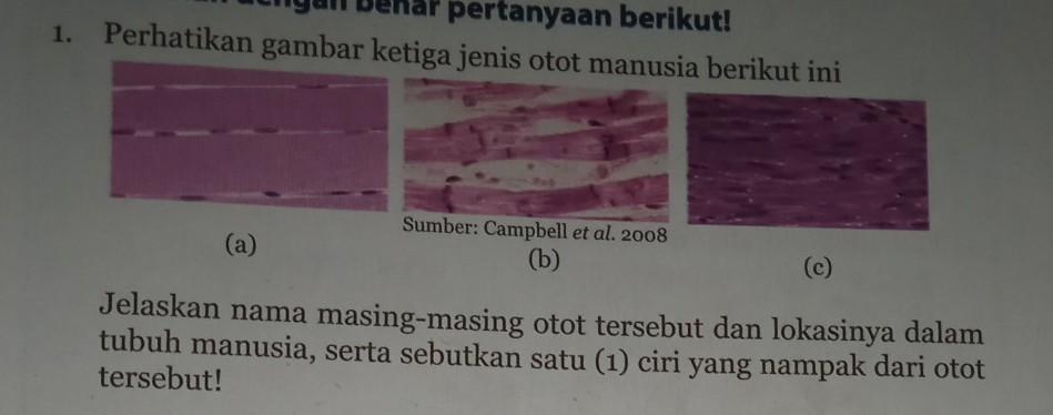 Detail Perhatikan Gambar Ketiga Jenis Otot Manusia Berikut Ini Nomer 13