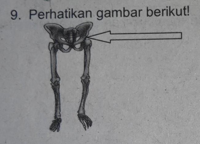 Detail Persendian Seperti Pada Gambar Merupakan Sendi Nomer 19