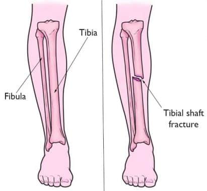 Detail Rangka Kaki Manusia Nomer 48