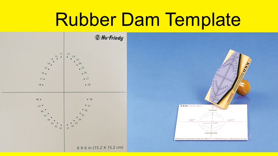 Detail Rubber Dam Stamp Template Nomer 20