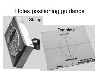 Detail Rubber Dam Stamp Template Nomer 29