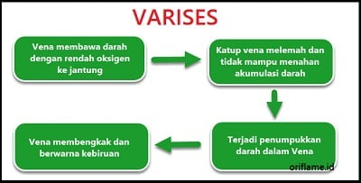 Detail Sebutkan 5 Contoh Gangguan Pada Organ Peredaran Darah Manusia Nomer 26