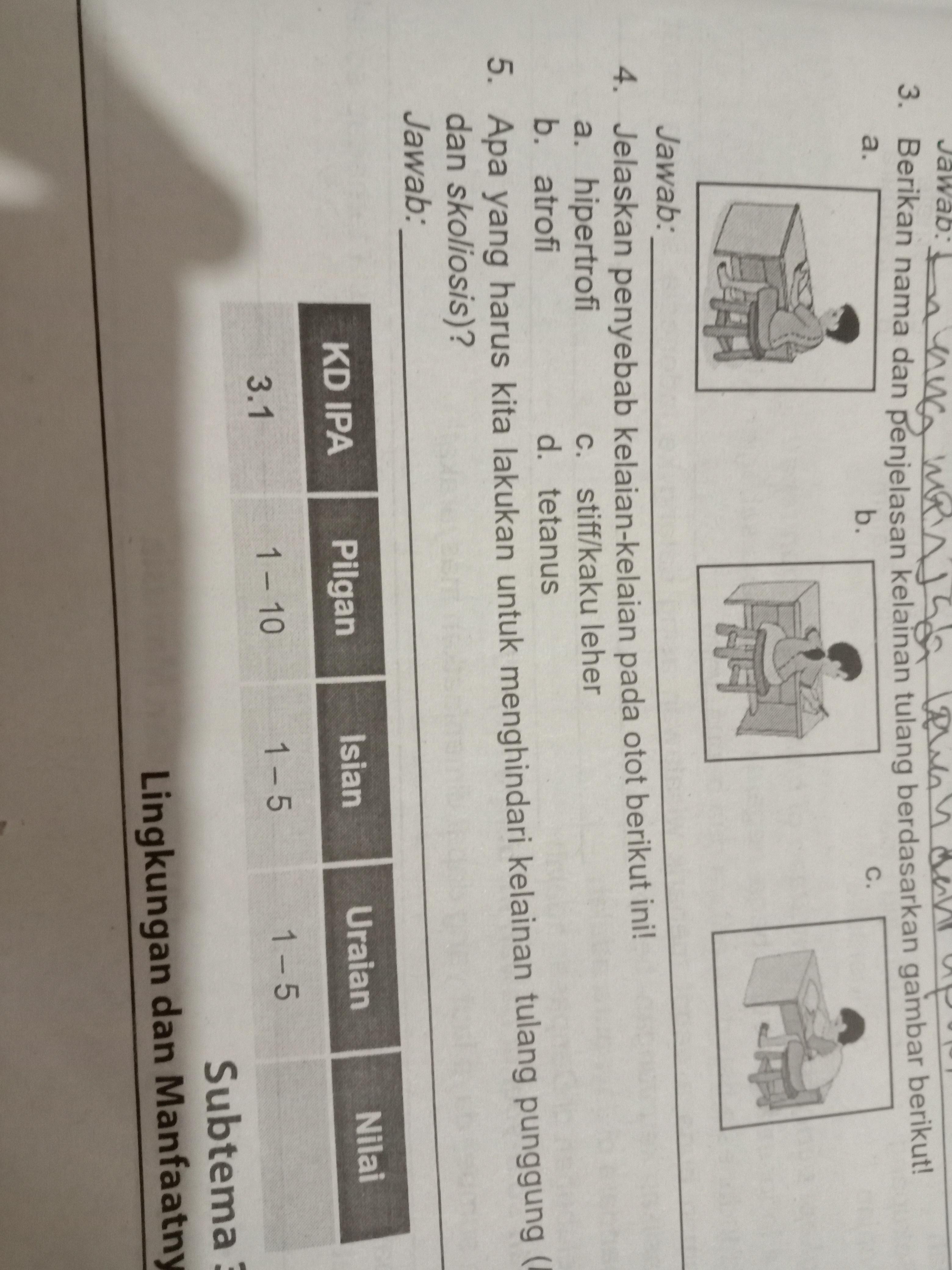 Detail Stiff Atau Kaku Leher Adalah Nomer 44