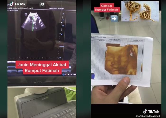 Detail Surat Fatimah Untuk Ibu Hamil Nomer 9