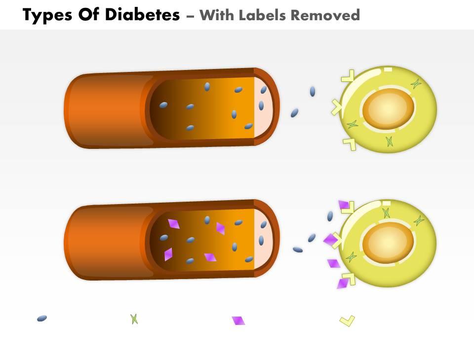 Detail Template Ppt Diabetes Mellitus Nomer 47