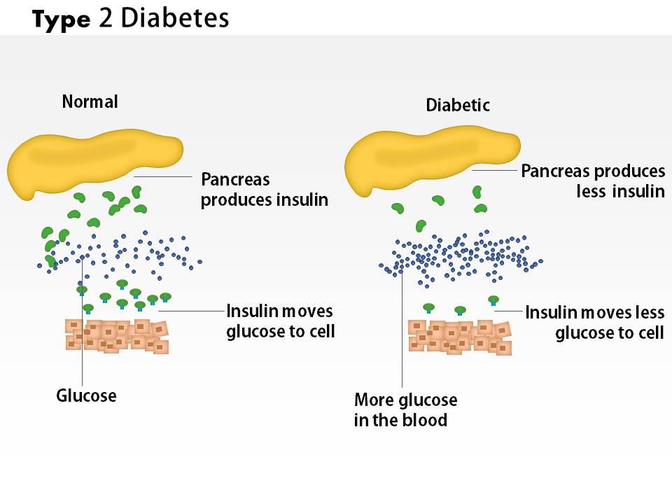 Detail Template Ppt Diabetes Mellitus Nomer 50