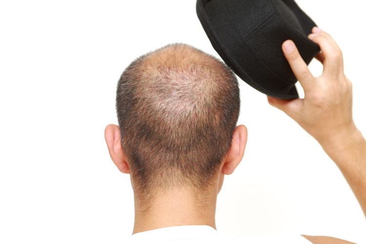 Detail Topi Untuk Orang Botak Nomer 13