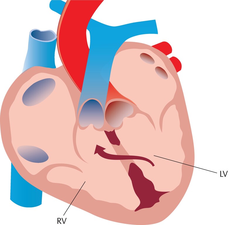 Detail Hypophyse Anatomie Nomer 16