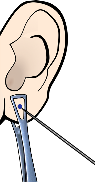 Detail Ear Piercing Clipart Nomer 13