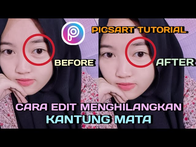 Edit Foto Menghilangkan Kantung Mata - KibrisPDR