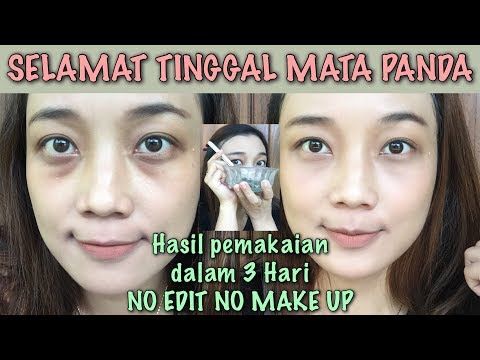 Detail Edit Foto Menghilangkan Kantung Mata Nomer 20