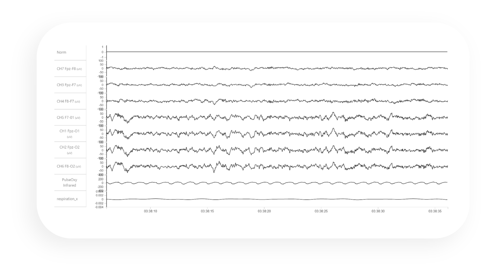 Detail Eeg Png Nomer 27