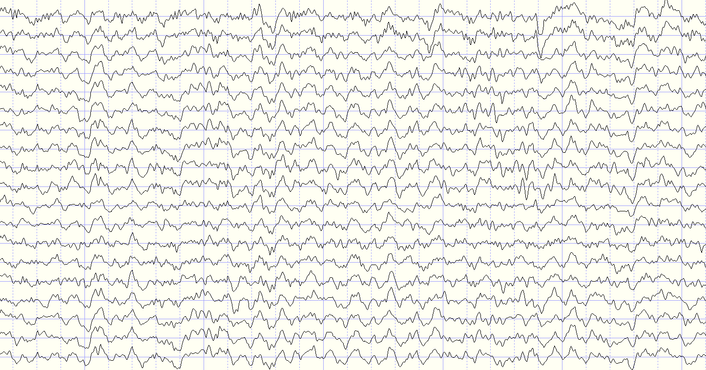 Detail Eeg Png Nomer 37