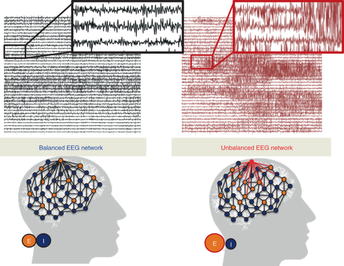 Detail Eeg Png Nomer 47