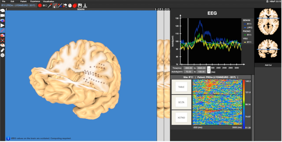 Detail Eeg Png Nomer 54