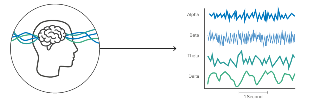 Detail Eeg Png Nomer 10