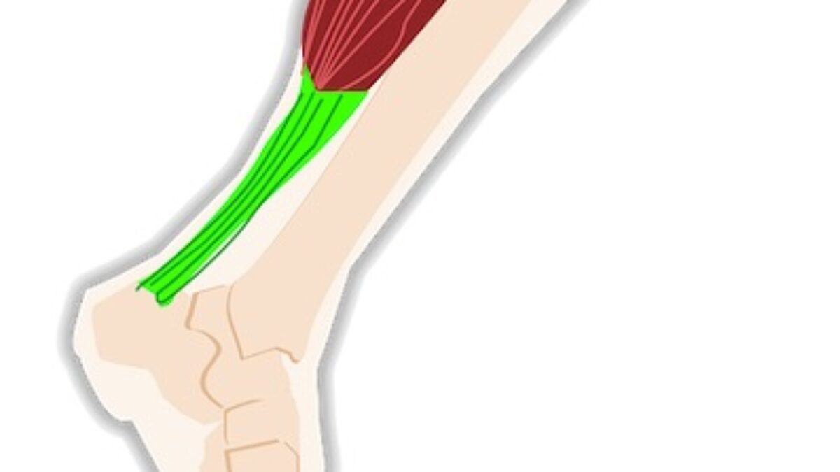 Detail Gracilis Muskel Nomer 6