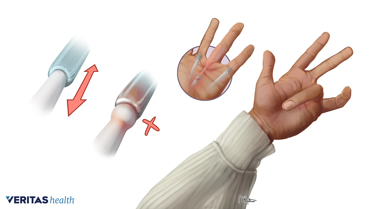 Detail Finger Picture Nomer 26