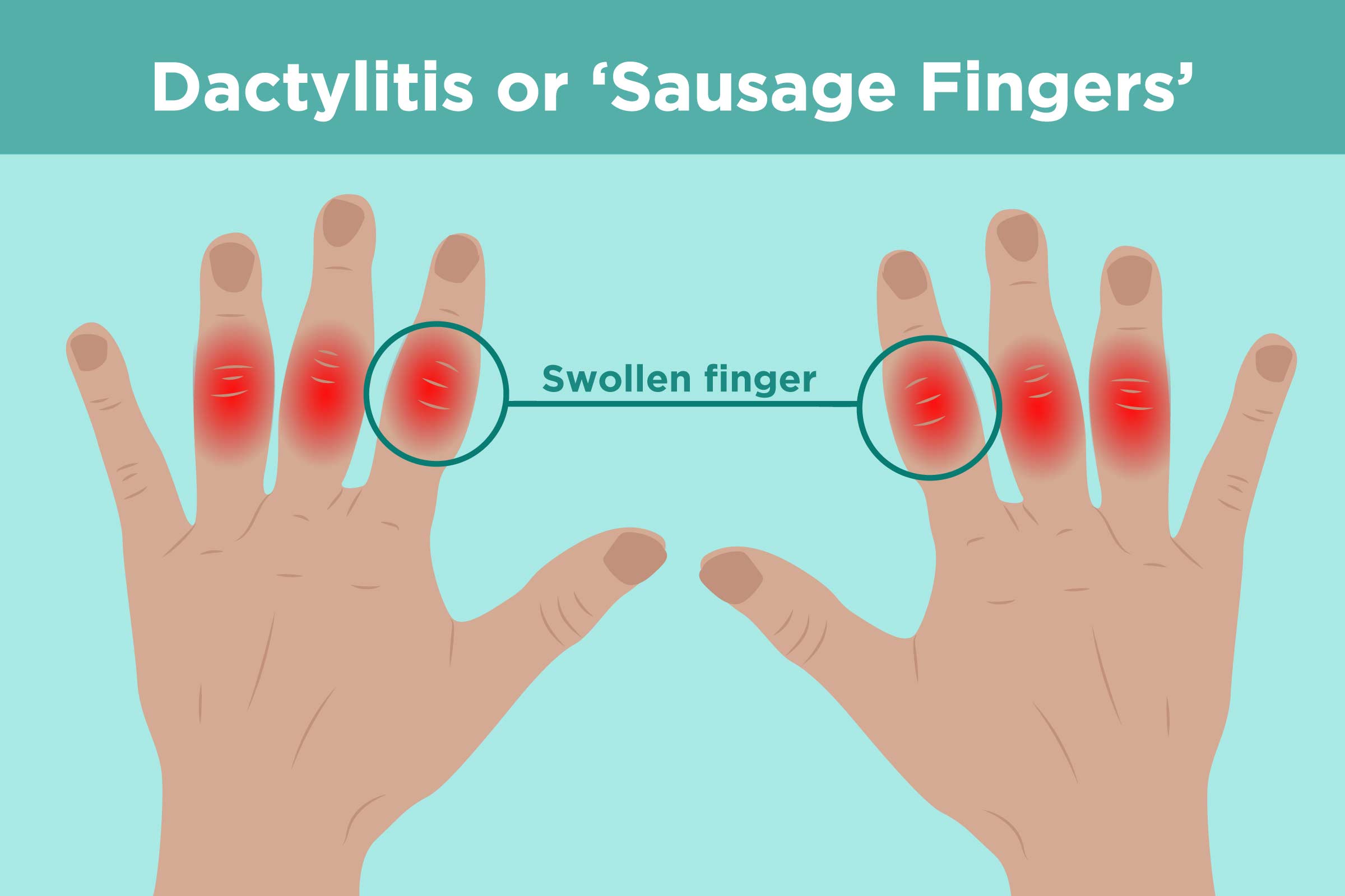 Detail Fingers Picture Nomer 31