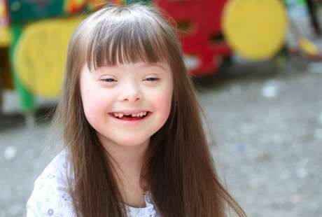 Detail Foto Anak Down Syndrome Nomer 14