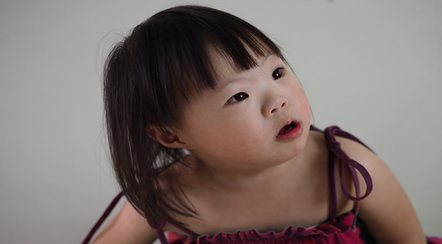 Detail Foto Anak Down Syndrome Nomer 25