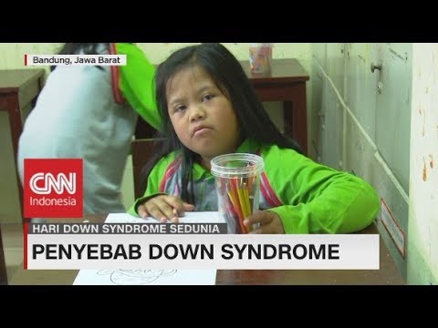 Detail Foto Anak Down Syndrome Indonesia Nomer 13