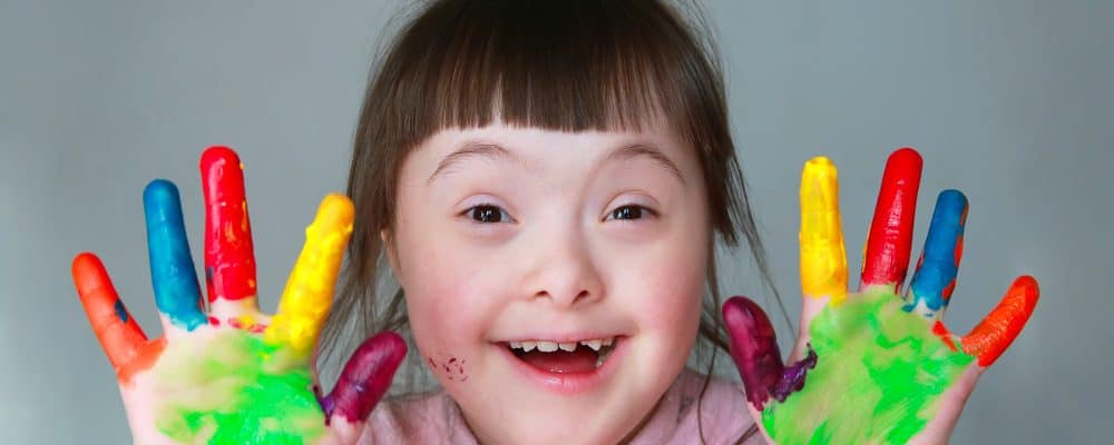 Detail Foto Anak Down Syndrome Indonesia Nomer 24