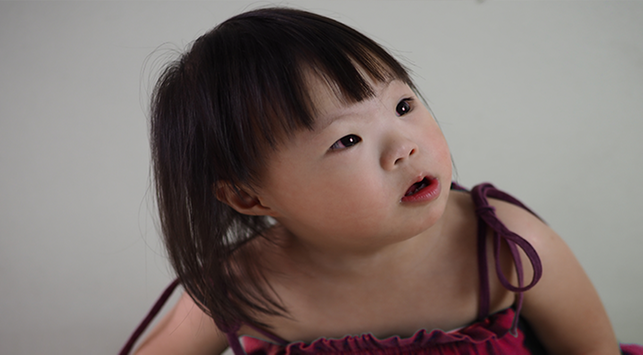 Detail Foto Anak Down Syndrome Indonesia Nomer 29