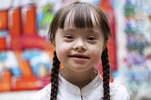 Detail Foto Anak Down Syndrome Indonesia Nomer 33