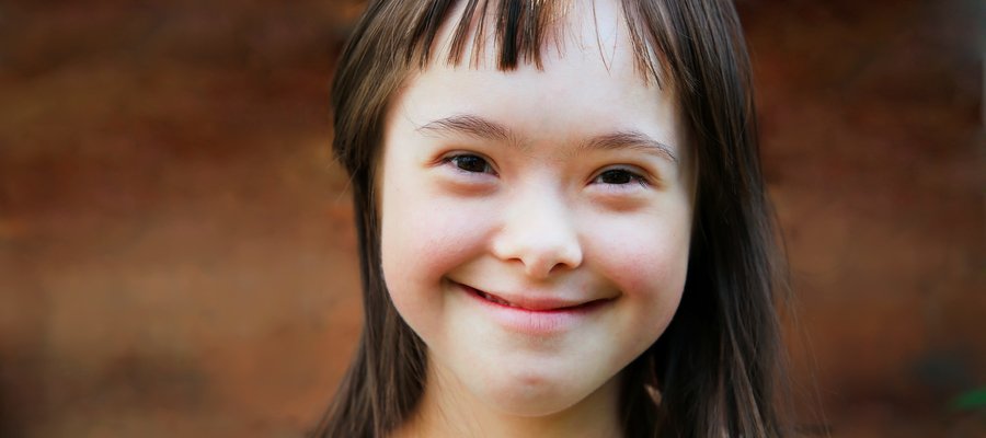 Detail Foto Anak Down Syndrome Indonesia Nomer 38