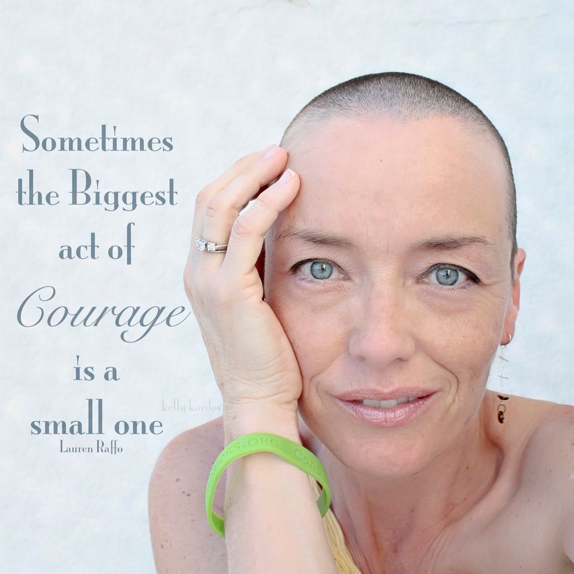 Bald Cancer Quotes - KibrisPDR