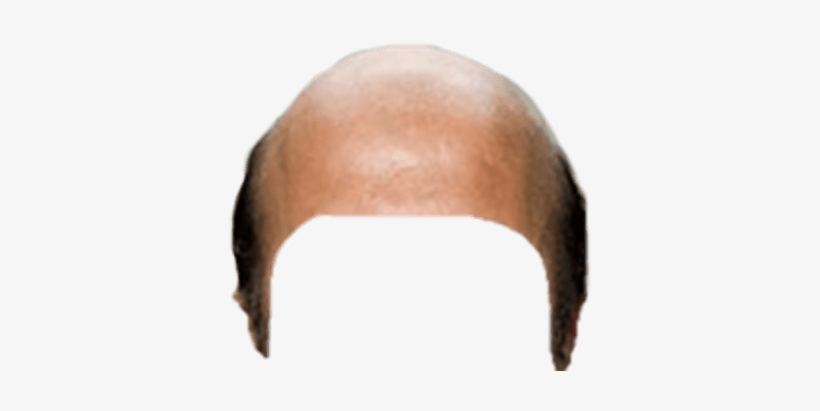 Detail Bald Png Nomer 4