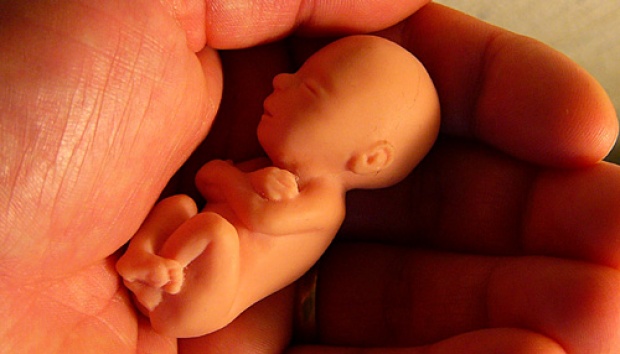 Detail Foto Bayi Aborsi Nomer 43