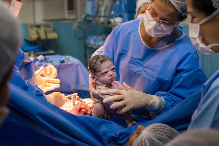 Detail Foto Bayi Baru Lahir Perempuan Nomer 7