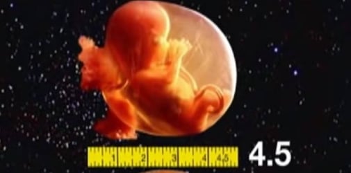 Detail Foto Bayi Dalam Kandungan 4 Bulan Nomer 31