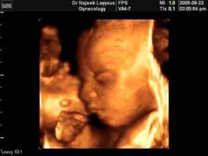 Detail Foto Bayi Dalam Kandungan 7 Bulan Nomer 22