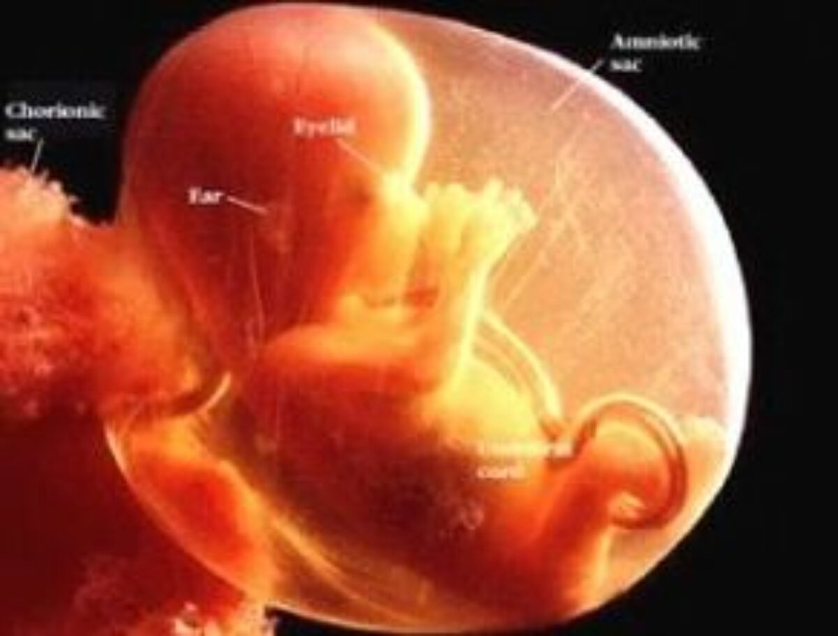 Detail Foto Bayi Dalam Kandungan 7 Bulan Nomer 40