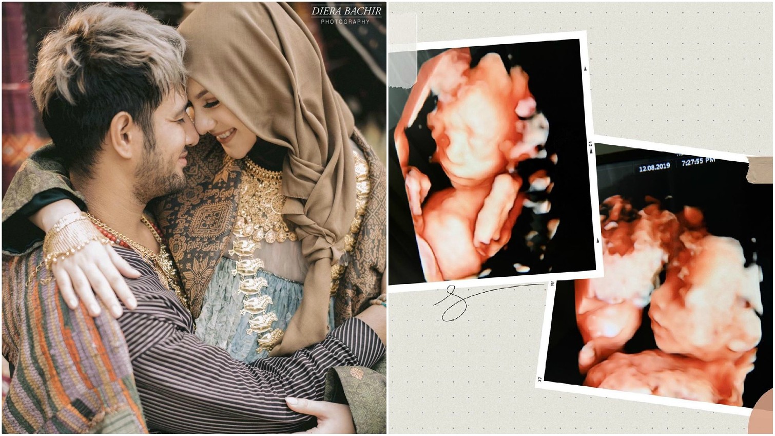 Detail Foto Bayi Irish Bella Nomer 53