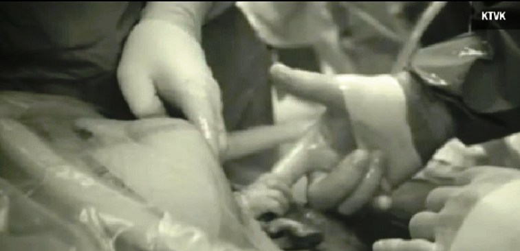 Detail Foto Bayi Keluar Dari Rahim Ibunya Nomer 15