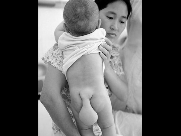 Detail Foto Bayi Teraneh Di Dunia Nomer 4